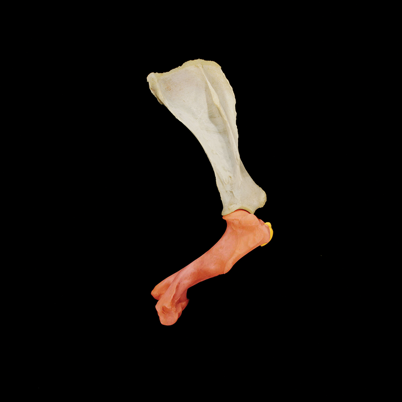 3D image of a leg bone.
