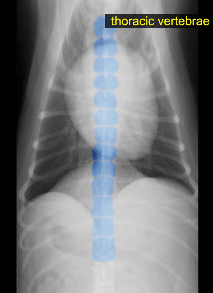 Radiographic image of a thoracic vertebrae.