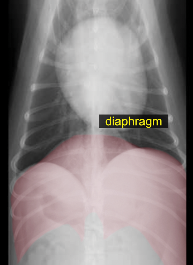 Radiographic image of a diaphragm.
